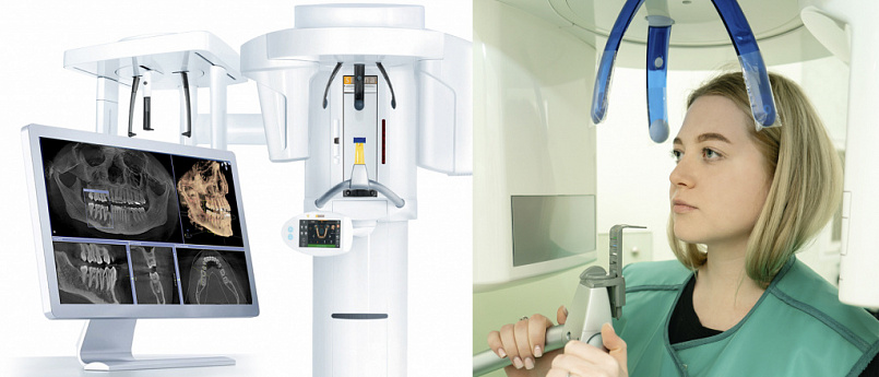 Рентгенографическая система с цефалостатом Orthophos XG 3D Ceph